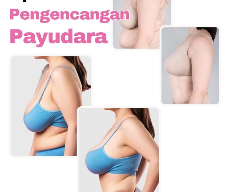 Operasi pengencangan payudara